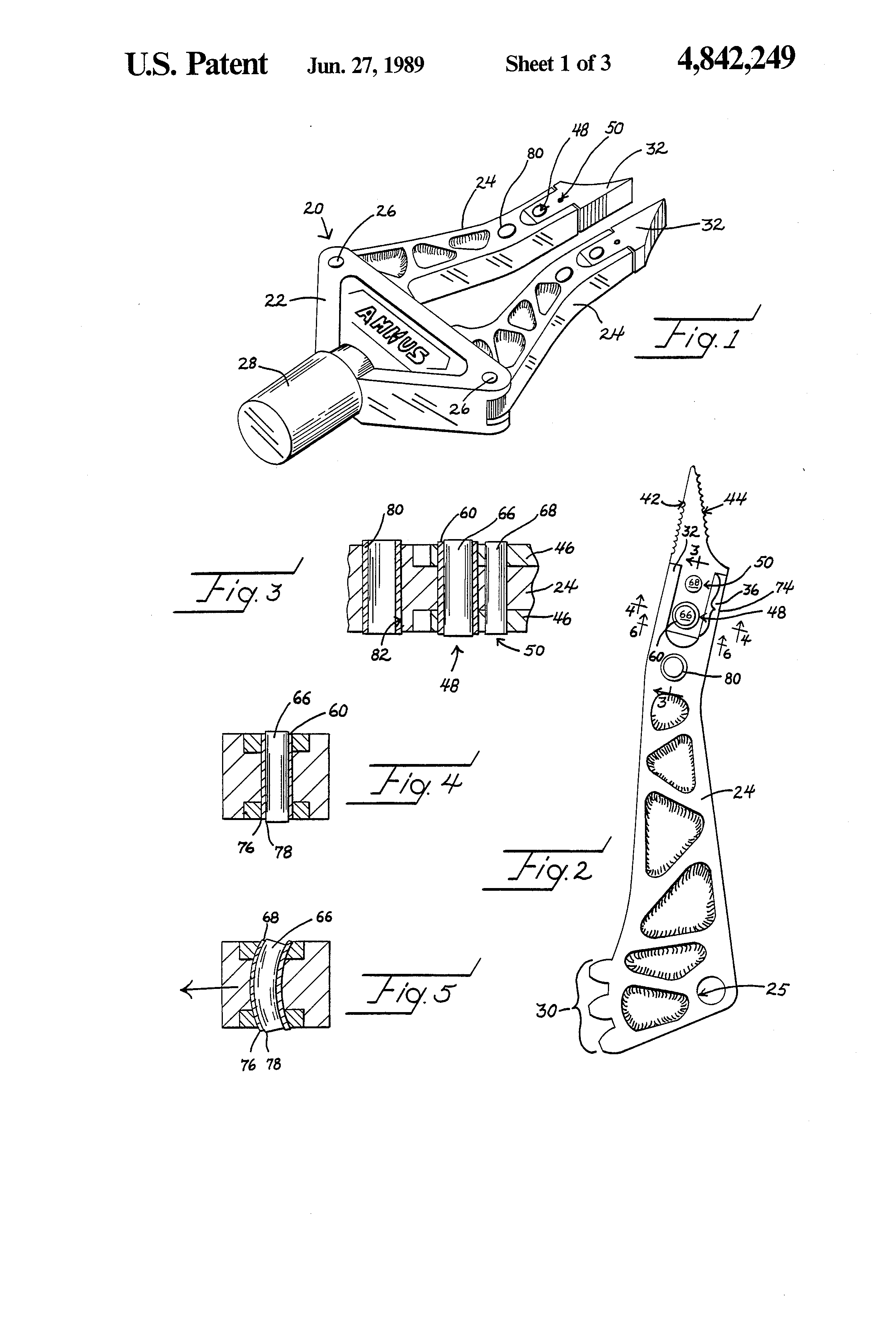 amkus-patent-extrication